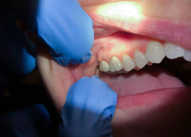 Urgent Tooth Repair in NY